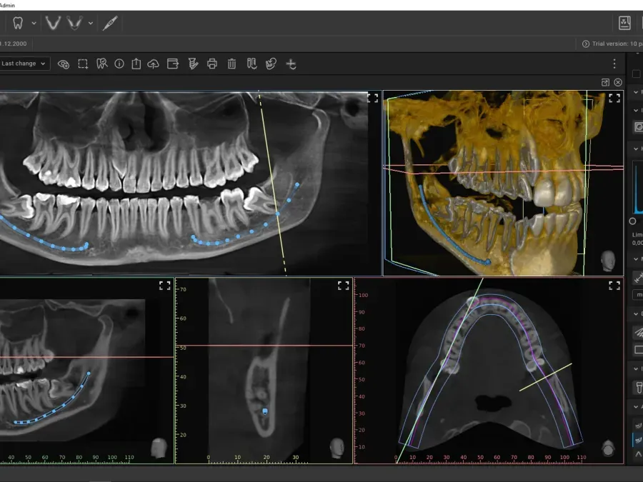 3D-Diagnostik und digitales Röntgen